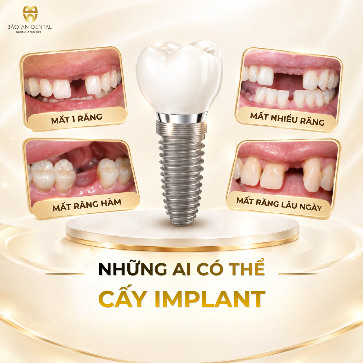 Những trường hợp có thể cấy Implant